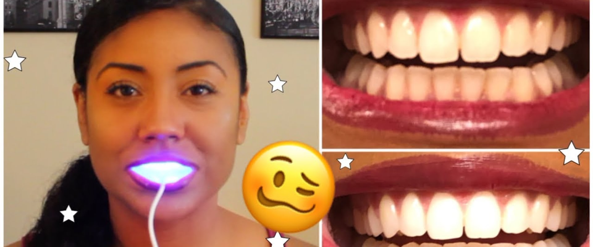 How to Get the Best Results from At-Home Teeth Whitening Kits