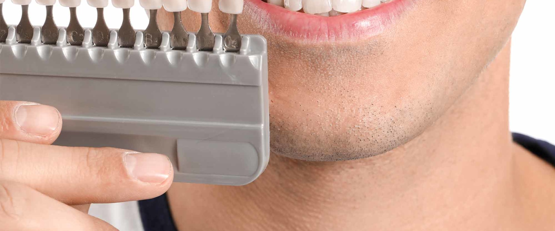 Hydrogen Peroxide: What You Need to Know About Teeth Whitening Products