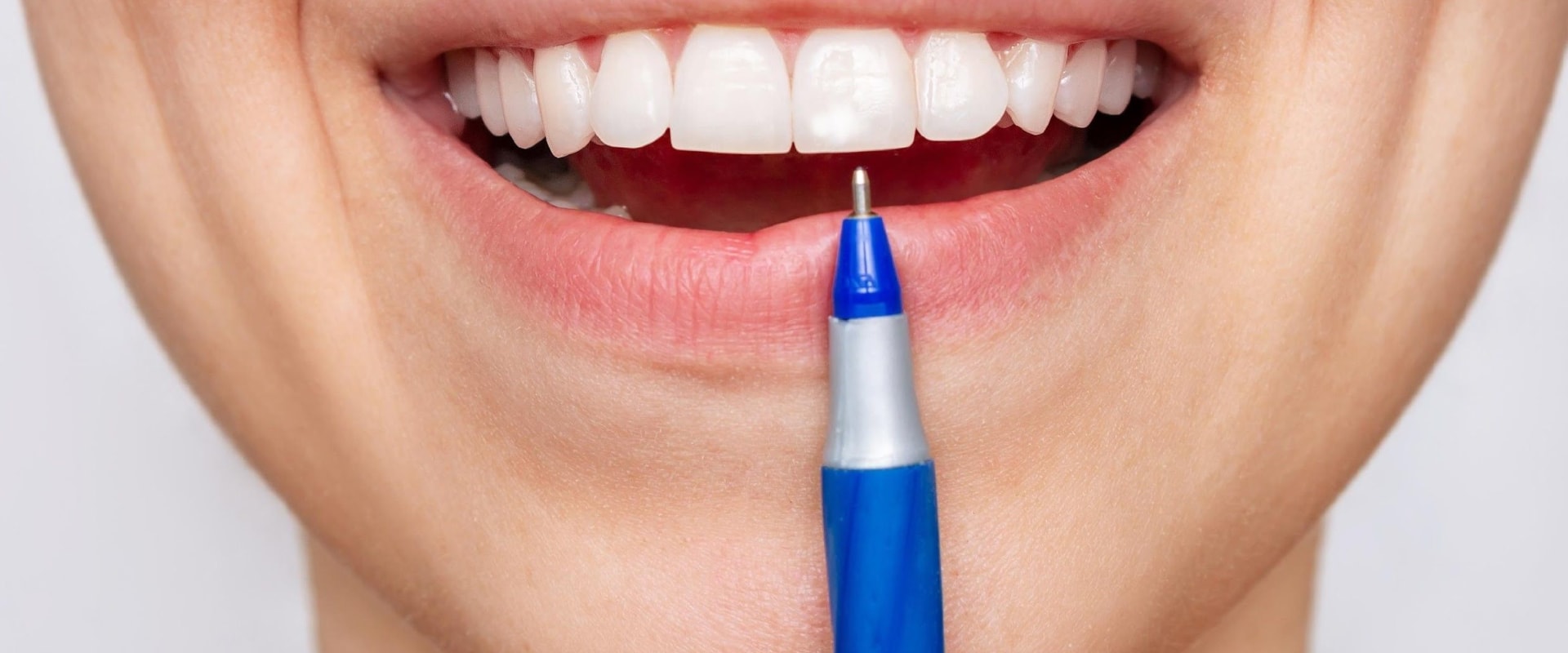 Whitening Pens: Tips for Using Teeth Whitening Products