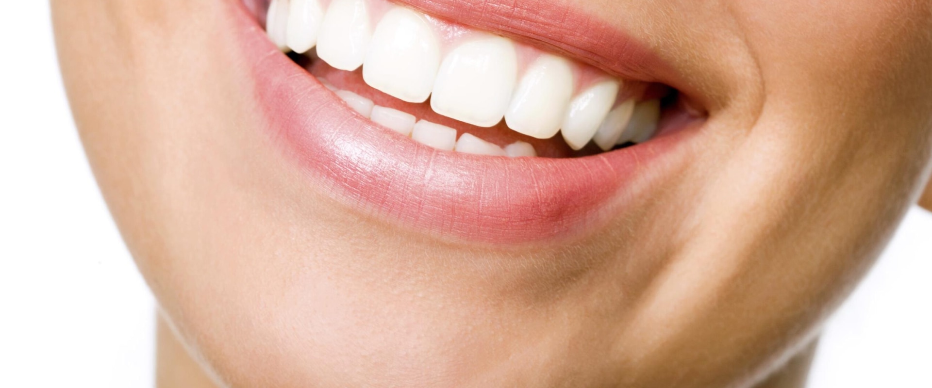 A Comprehensive Overview of AuraGlow: A Leading Teeth Whitening Brand