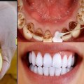 Baking Soda and Lemon Juice Paste: An All-Natural Teeth Whitening Remedy
