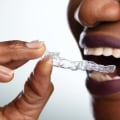 The Cost of At-Home Teeth Whitening Kits