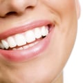 A Comprehensive Overview of AuraGlow: A Leading Teeth Whitening Brand