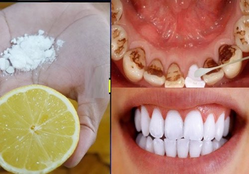 Baking Soda and Lemon Juice Paste: An All-Natural Teeth Whitening Remedy