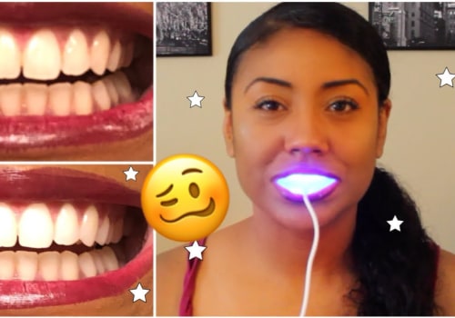 Review of Strips and Gels for Teeth Whitening
