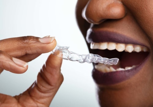 Whitening Gels: Types of Teeth Whitening Products