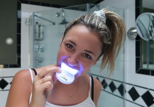At-Home Teeth Whitening Kits: How They Work